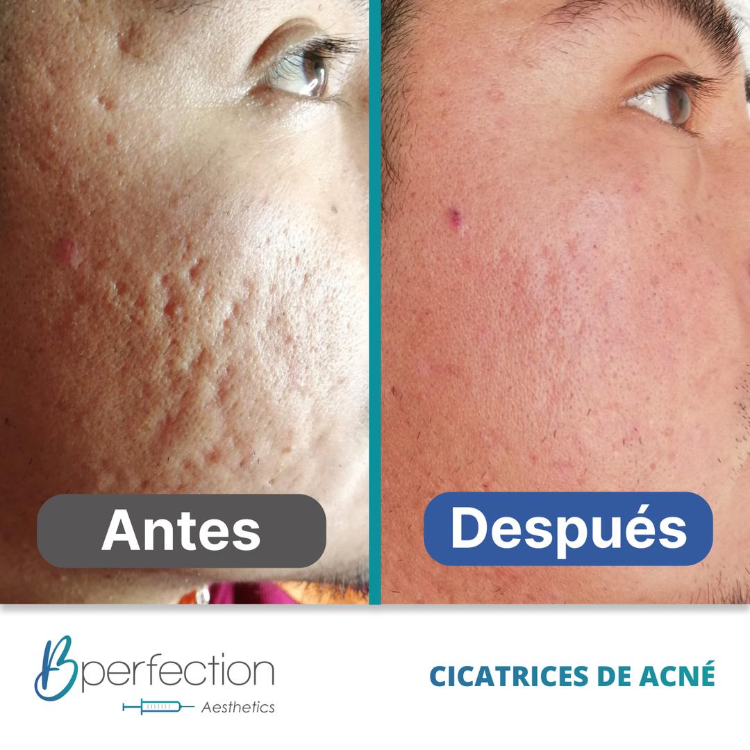 Imagen de resultado