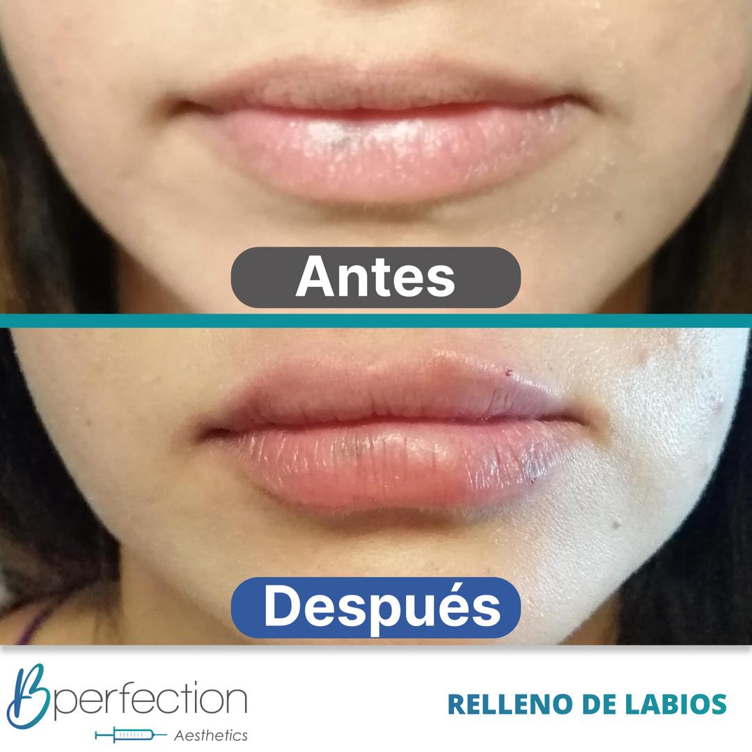 Imagen de resultado