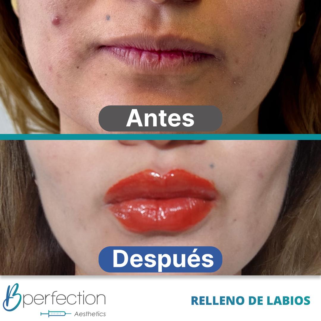 Imagen de resultado