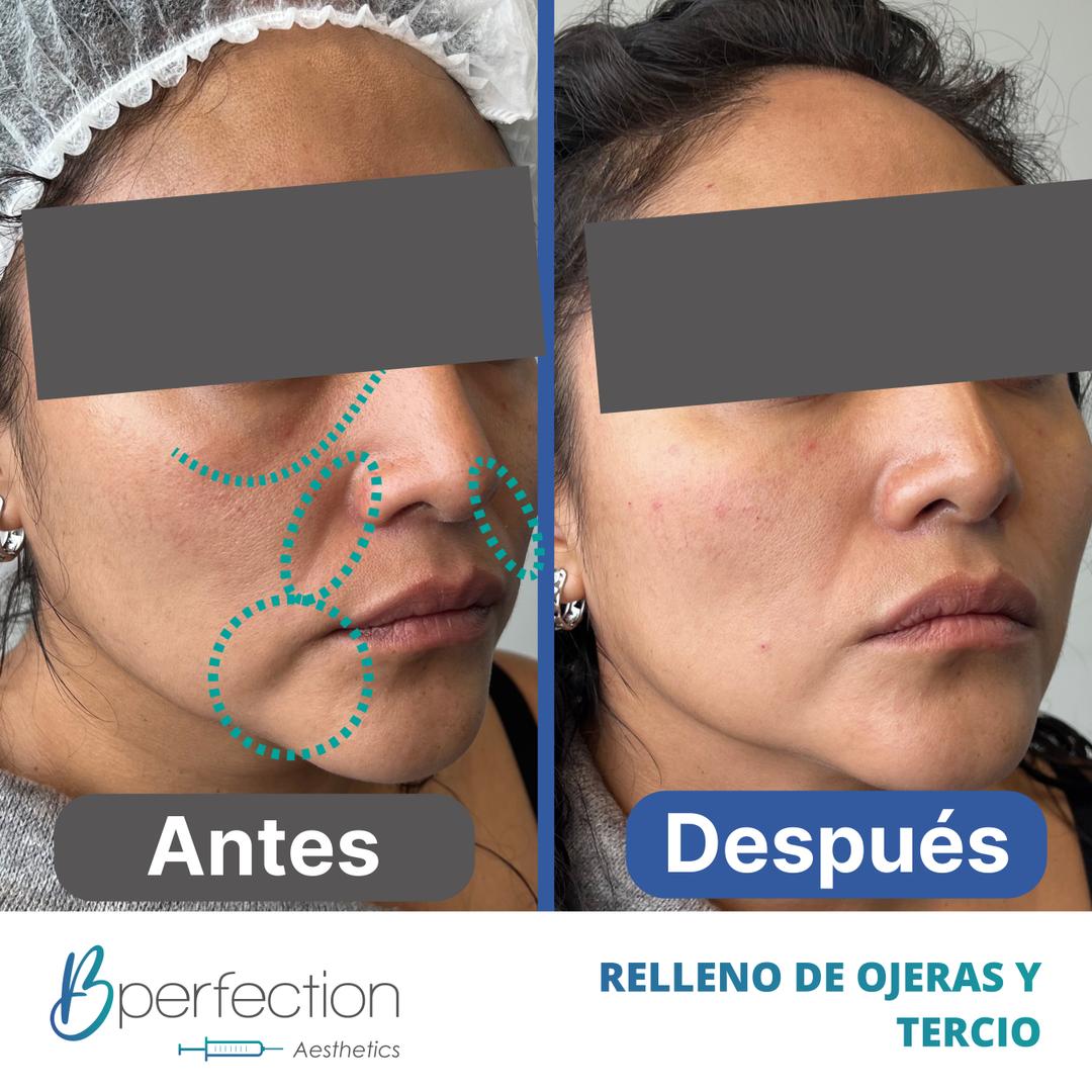 Imagen de resultado