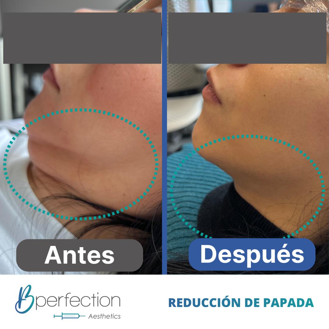 Imagen de resultado