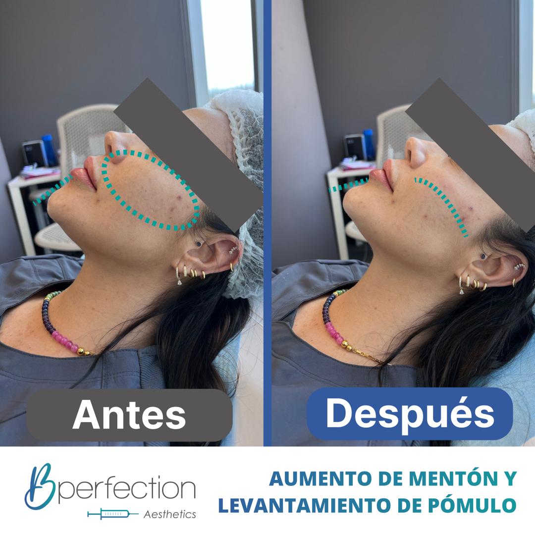 Imagen de resultado