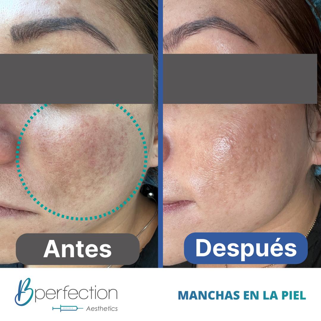 Imagen de resultado