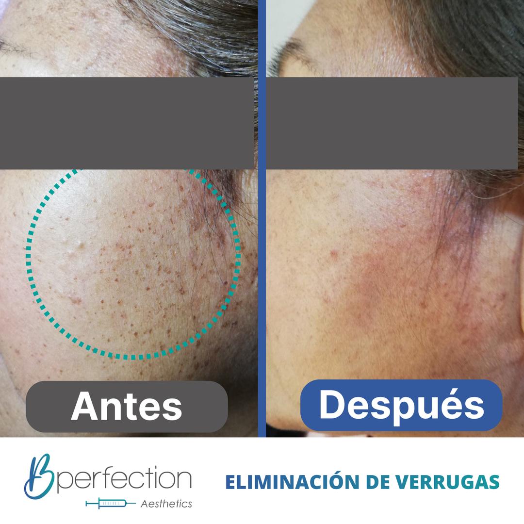 Imagen de resultado