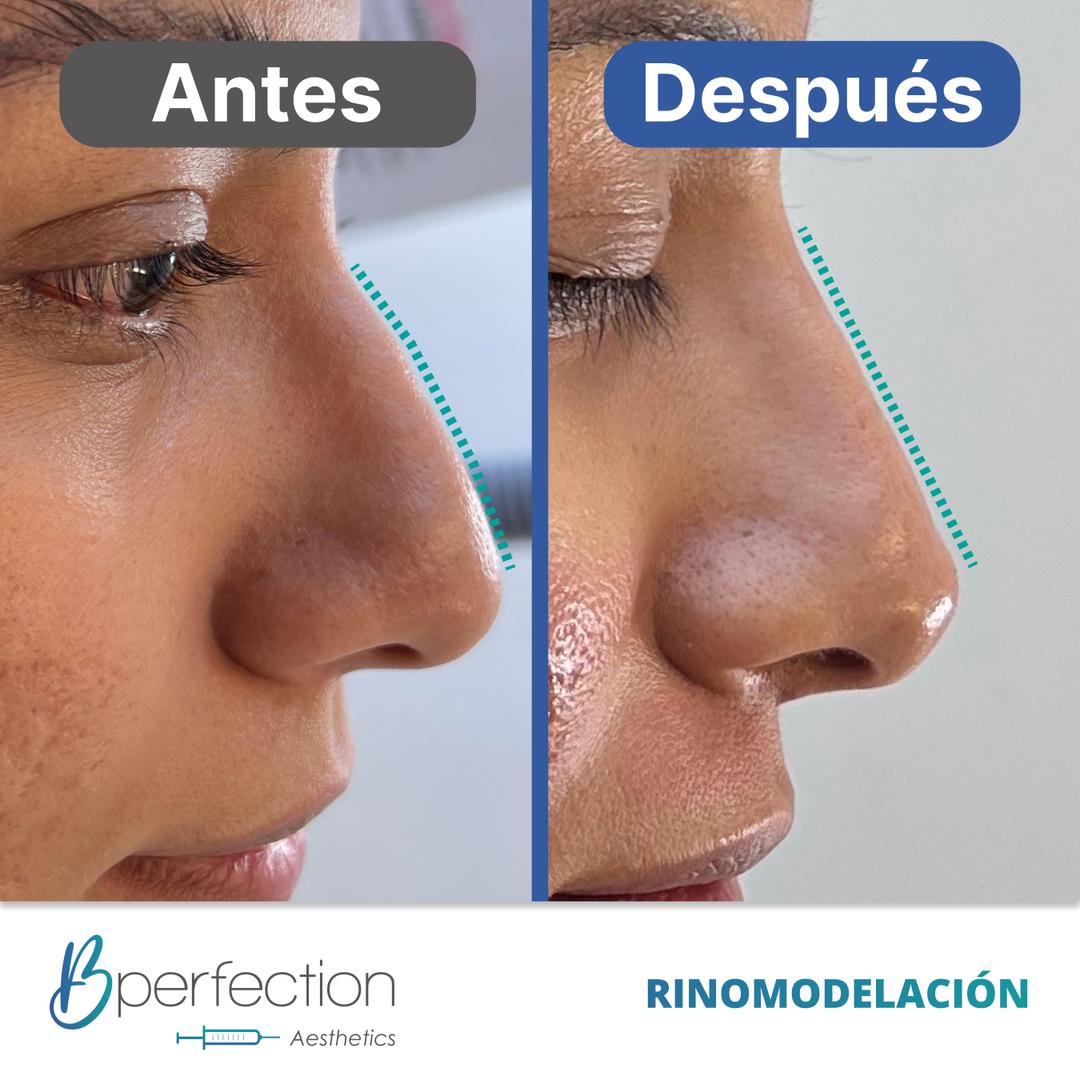 Imagen de resultado