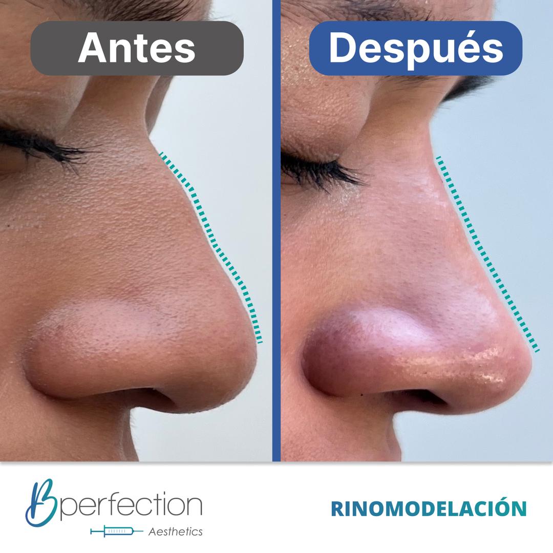 Imagen de resultado