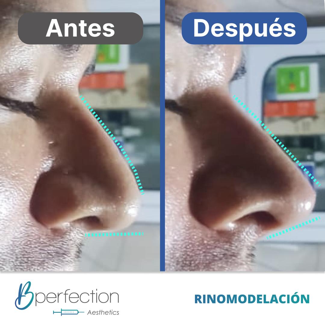 Imagen de resultado